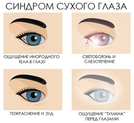 Лечение синдрома сухого глаза. Компания АртОптика г. Челябинск